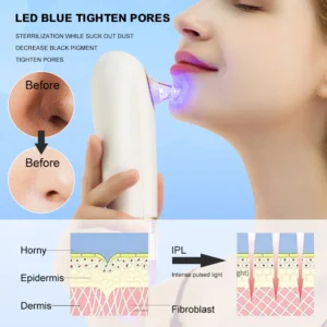 Machine électrique pour enlever les points noirs à petites bulle