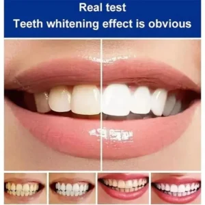 Dentifrice carie probiotique