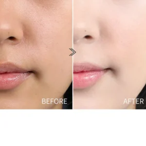 Ampoule d'acide hyaluronique